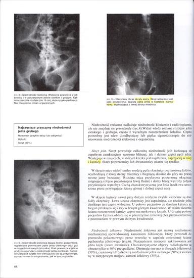 ABC Radiologii Stanów Nagłych - D.Nicholson - 68.jpg